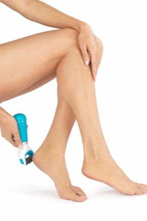 Electric foot file